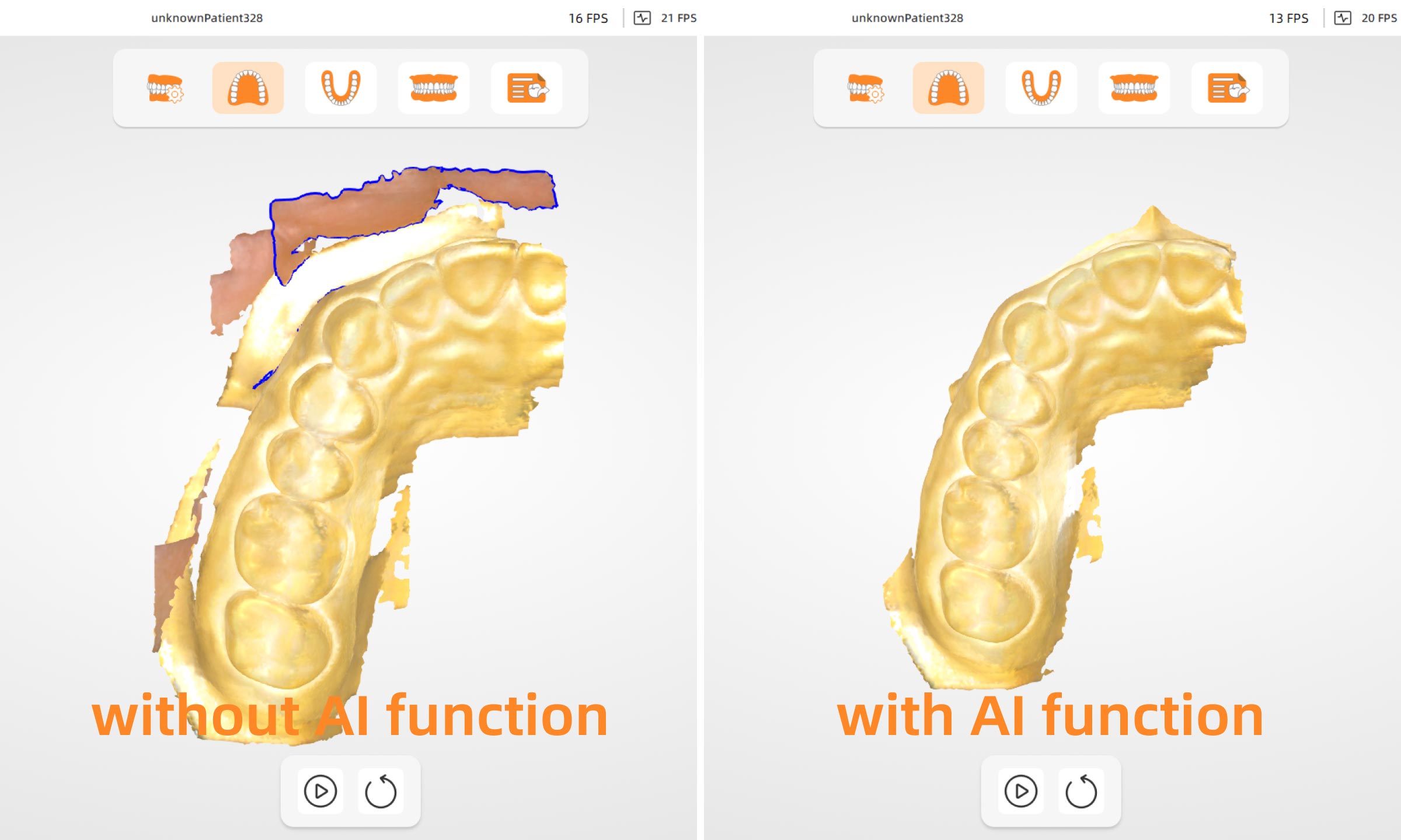 AI Scan Filtering